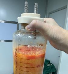 孟州水动力吸脂手术要做多久？